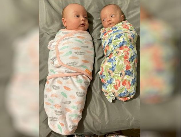 Jedna z bliźniaczek urodziła się trzy razy mniejsza od drugiej