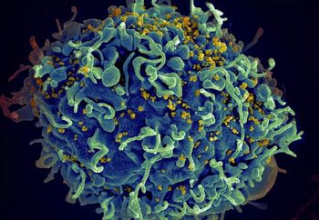 Jak wywabić wirusa HIV z komórek? Naukowcy znaleźli sposób