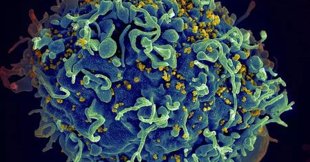 Jak wywabić wirusa HIV z komórek? Naukowcy znaleźli sposób