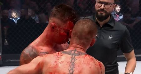 Tak wyglądali po walce MMA. Zdjęcie tylko dla ludzi o mocnych nerwach