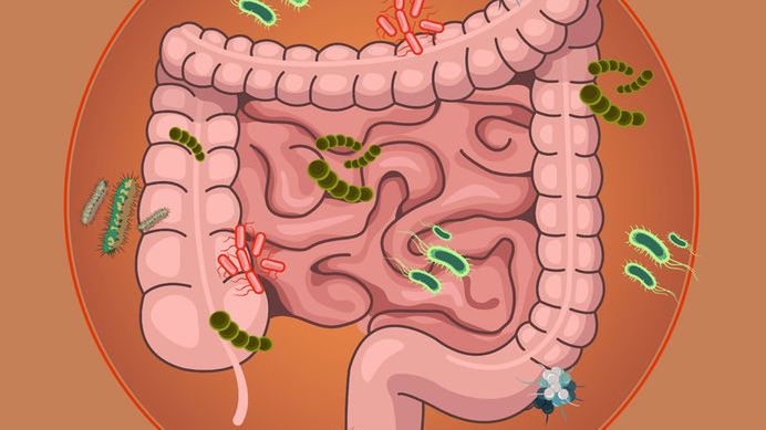 Nietypowe przyczyny zespołu nieszczelnego jelita 