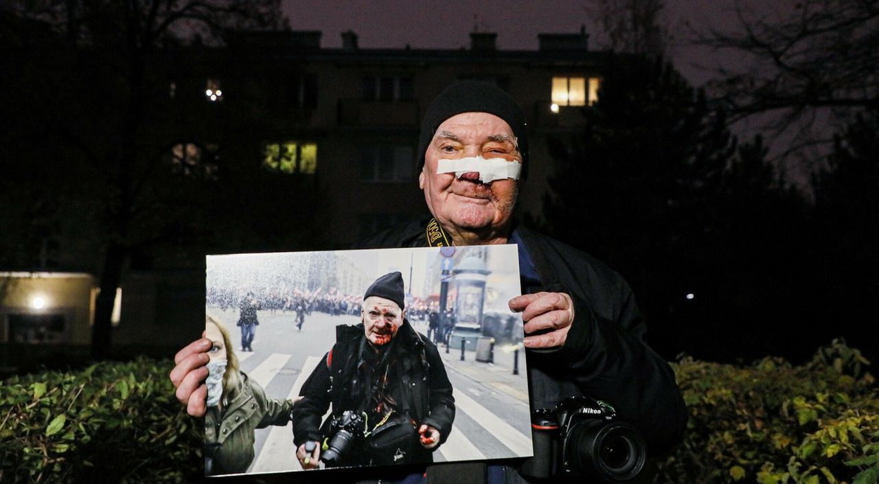 Marsz Niepodległości. Postrzelony fotoreporter żąda odszkodowania. Podał kwotę