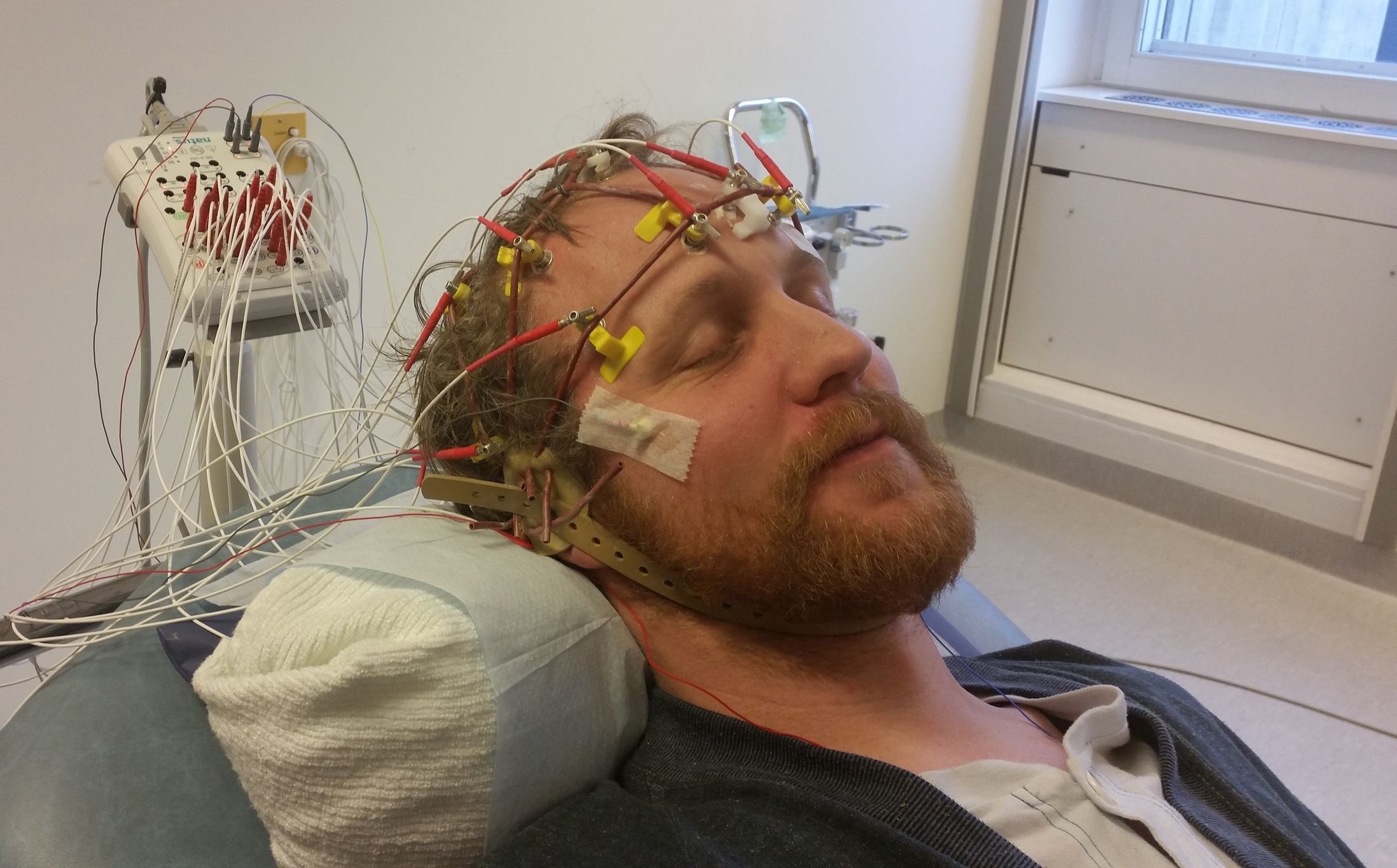 Close-Up Of Young Man With Medical Equipment On Bed At Hospital WardMarcus Leidner / EyeEmOne Person, Medical Clinic, Electrode, Medical Exam, Examining, Science, Hospital Ward, High Angle View, Eyes Closed, Day, Sleeping, Lying On Back, Power Line, Young Men, Indoors, Mustache, Research, Lying Down, Cable, EEG, Human Nervous System, Bed, Epilepsy, Real People, Medical Equipment, Human Face, Close-Up, Healthcare And Medicine, Scientific Experiment, Hospital, Young Adult, Beard, Mental Health, Neuroscience, Caucasian Ethnicity, 35-39 Years, Mid Adult Men, Horizontal Image