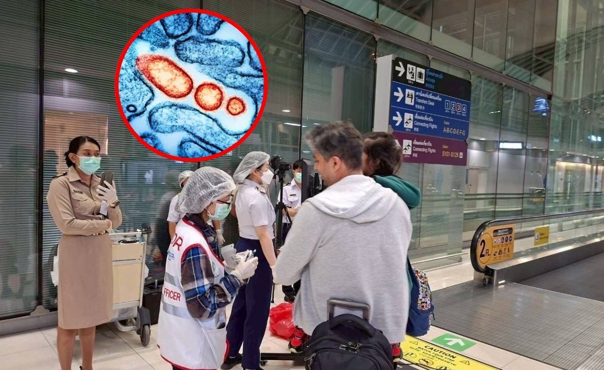 Wirus Nipah nie grozi epidemią w Europie