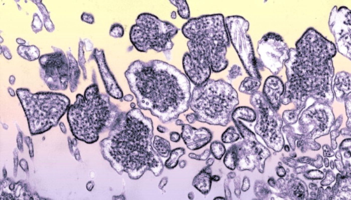 Nowa groźna choroba z Chin. Wirus Nipah zabija 75 proc. zarażonych