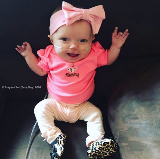 Dziewczynka z wrodzoną wadą serca i heterotaksją/ Facebook