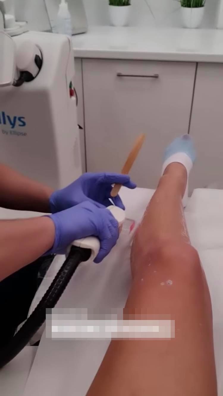 Sylwia Peretti odwiedza gabinet medycyny estetycznej