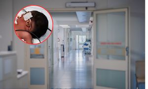 Noworodek z dwiema głowami. Rzadki przypadek w Indiach