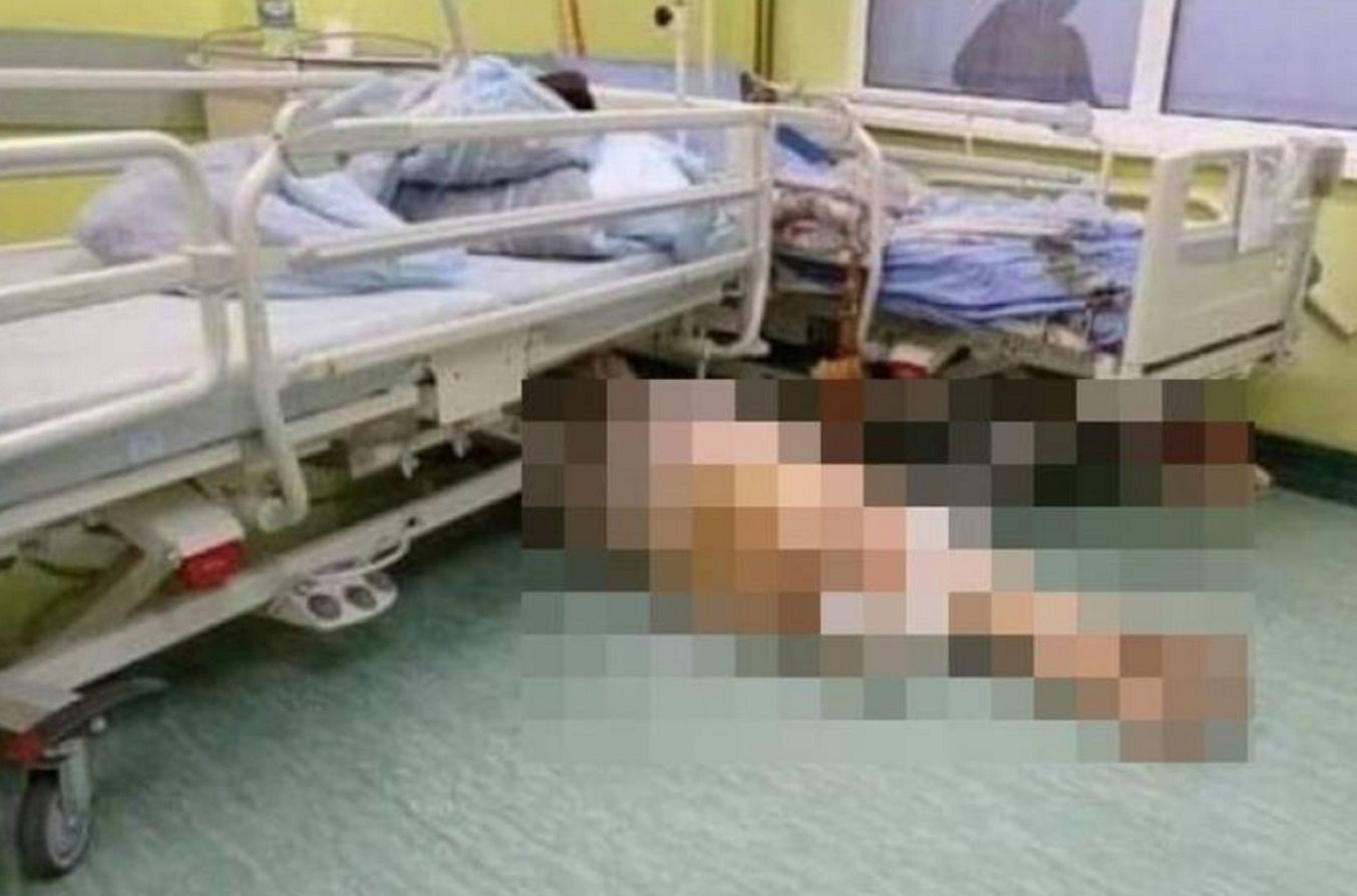 Skandal w szpitalu w Zgierzu. Wstrząsające zdjęcia trafiły do sieci