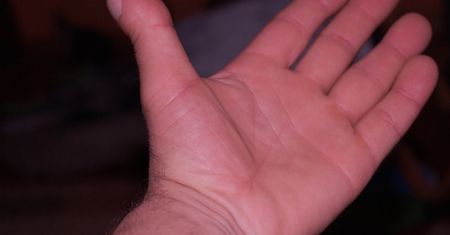 Ostrzega o udarze. "Należy niezwłocznie udać się po poradę lekarską"