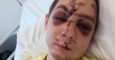 Zatrzymano kierowcę, który potrącił 22-letniego Kacpra