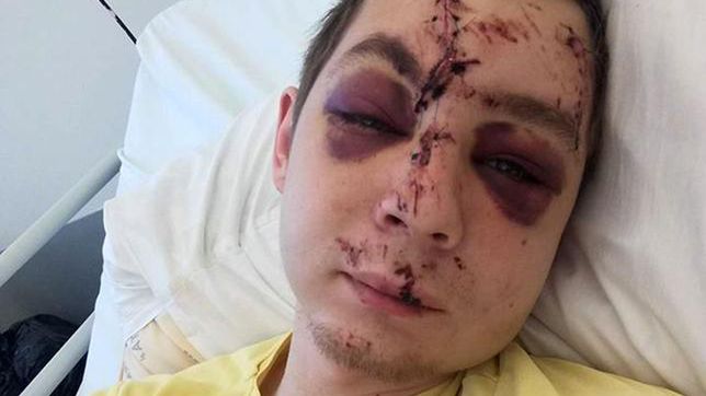 22-letni Kacper nadal przebywa w szpitalu