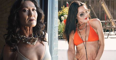 26-latka pokochała swoje zmarszczki. Potem została modelką