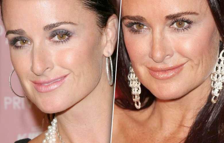 Demi Moore miała operację plastyczną nosa? Zdjęcia przed i po