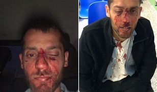 Atak na izraelskich studentów w Warszawie. Będzie śledztwo, jest reakcja Ambasady Izraela