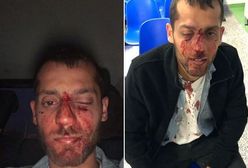 Atak na izraelskich studentów w Warszawie. Będzie śledztwo, jest reakcja Ambasady Izraela