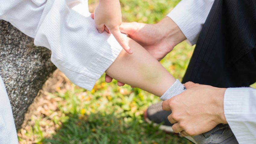 Maść arnikowa to preparat, który wzmacnia naczynia włosowate. Stosuje się ją w leczeniu siniaków, obrzęków oraz dolegliwości reumatycznych.