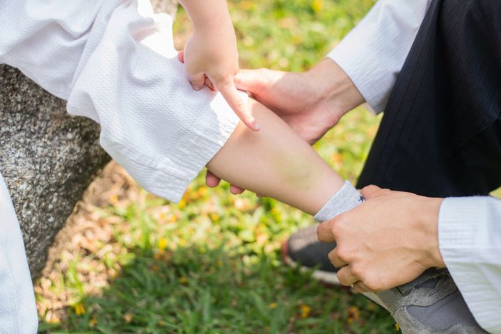 Maść arnikowa to preparat, który wzmacnia naczynia włosowate. Stosuje się ją w leczeniu siniaków, obrzęków oraz dolegliwości reumatycznych.