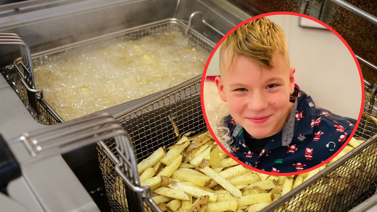 Gorąca frytura poparzyła mu ciało. Kuba walczy o życie. 