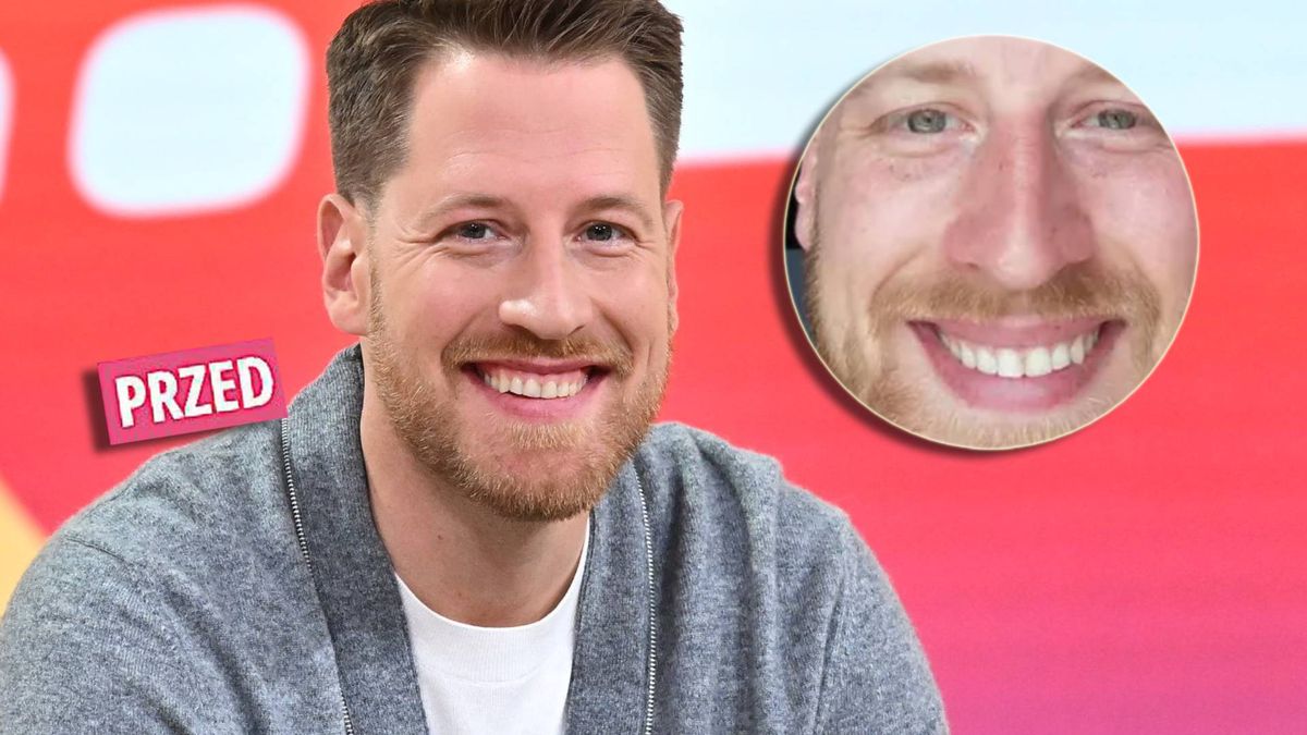 Stockinger, metamorfoza