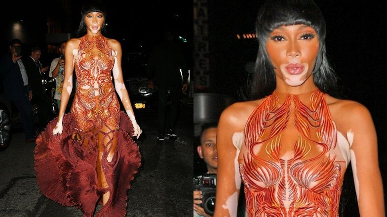Winnie Harlow w drodze na after party