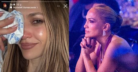 Jennifer Lopez miała WYPADEK na próbie i rozwaliła sobie nos