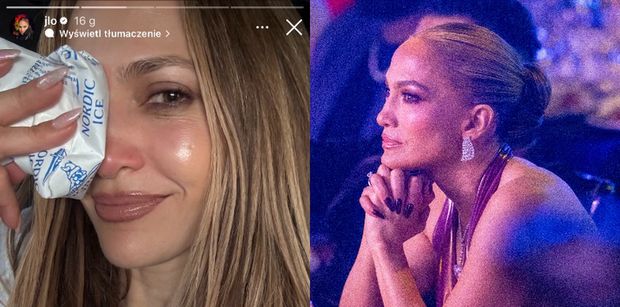 Jennifer Lopez miała WYPADEK na próbie i rozwaliła sobie nos