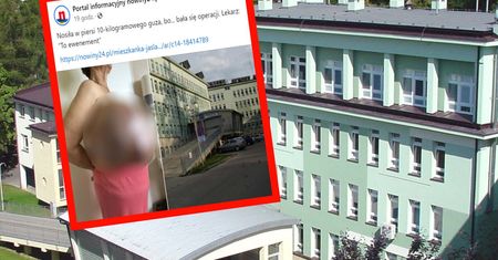 Niecodzienny przypadek w Jaśle. 64-latka z gigantycznym guzem w piersi