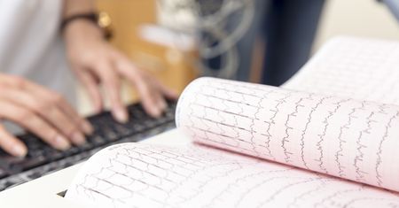 Jest 14 razy skuteczniejszy niż technicy. Algorytm pomoże wykrywać arytmię