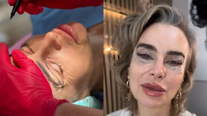 Kasia Nast poszła pod nóż