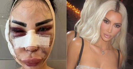 Brazylijska modelka wydała ponad 3 MILIONY ZŁOTYCH, aby upodobnić się do Kim Kardashian. Do dziś ŻAŁUJE decyzji. Jak teraz wygląda? (FOTO)
