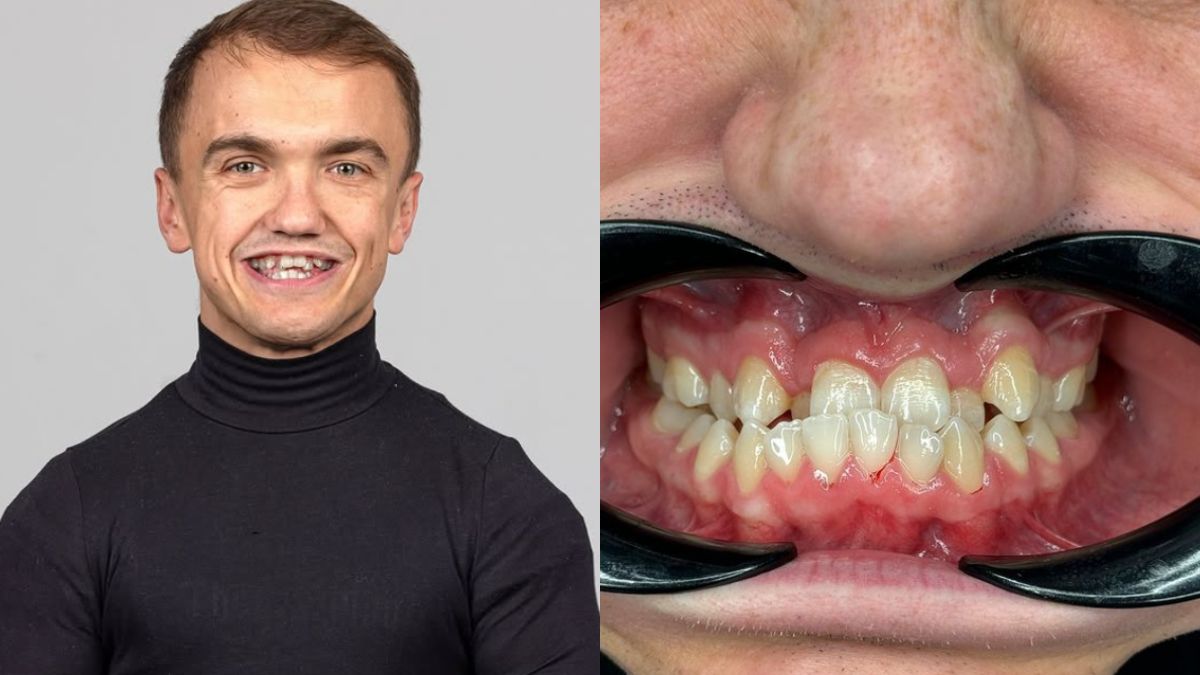 Mini Majk pokazał swoje nowe zęby