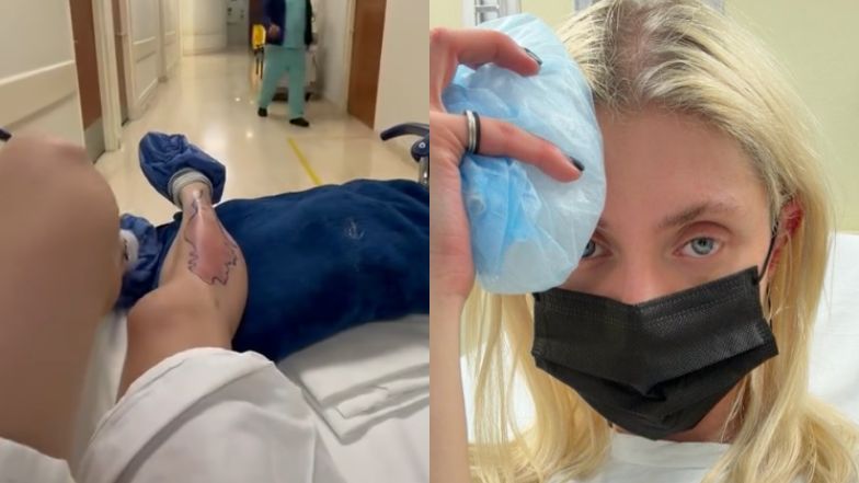 Taylor Momsen ukąszona przez jadowitego pająka