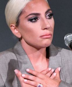 Prawie zginął, wyprowadzając psy Lady Gagi. Wylądował na ulicy