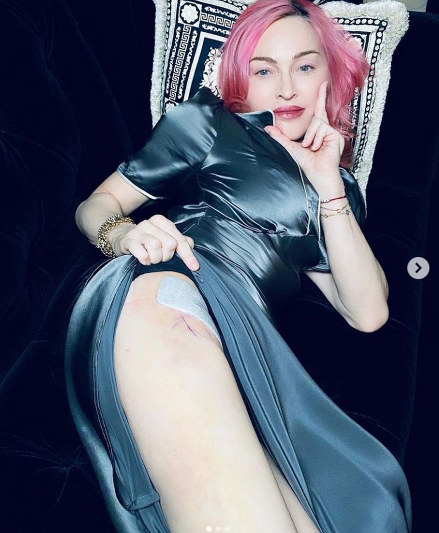 Madonna