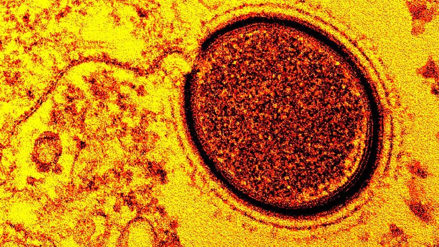 Komórka wirusa Mollivirus sibericum, który leżał w wiecznej zmarzlinie przez 30 tysięcy lat.