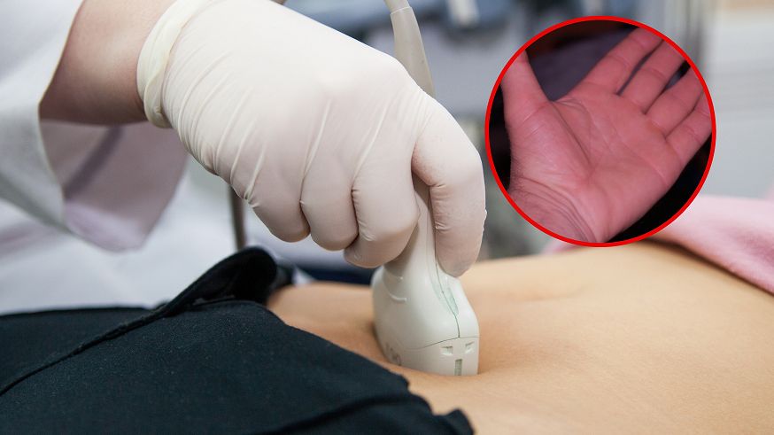 Dłonie zdradzą, że wątroba nie daje rady. Od razu biegiem do hepatologa