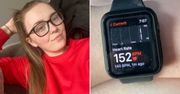 Apple Watch uratował życie ciężarnej 24-latki. Niezwykła historia