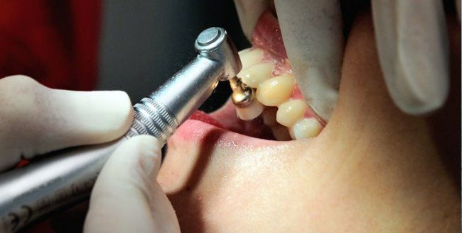 Dentofobia - dlaczego faceci boją się dentysty?