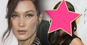 Bella Hadid przeszła operację plastyczną nosa! Tak wyglądała przed zabiegiem