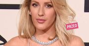 Ellie Goulding poddała się operacji plastycznej? Jej twarz zmieniła się nie do poznania. Efekty widać gołym okiem