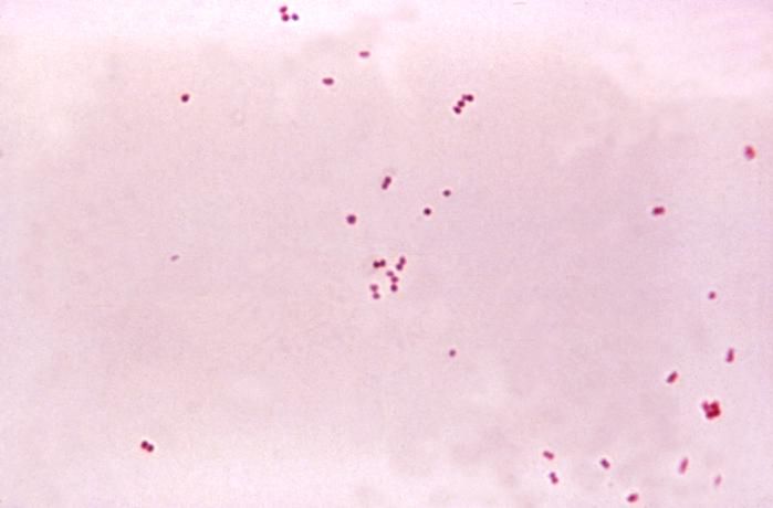 Mikroskopowy obraz bakterii Neisseria meningitidis