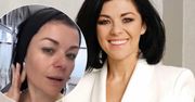 Kasia Cichopek zdradziła sekret swojej urody. Zrobiła zabieg, który stosują gwiazdy Hollywood!