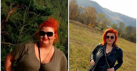 Anna przeszła operację zmniejszania żołądka. "To nie była żadna zachcianka"