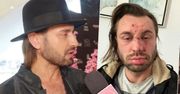 Rafał Grabias został skatowany w ścisłym centrum miasta. Jest ktoś, kto pomaga mu wyjść z traumy [WIDEO]