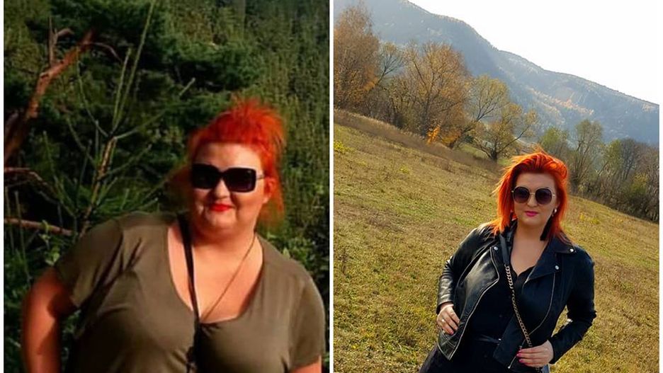 Anna przed i po operacji zmniejszenia żołądka