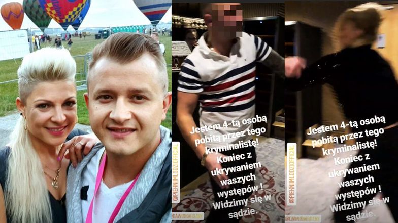 TYLKO NA PUDELKU: Partnerka wokalisty "Pięknych i Młodych" o pobiciu: "Mam przestawioną szczękę i prawdopodobnie pęknięty bębenek"