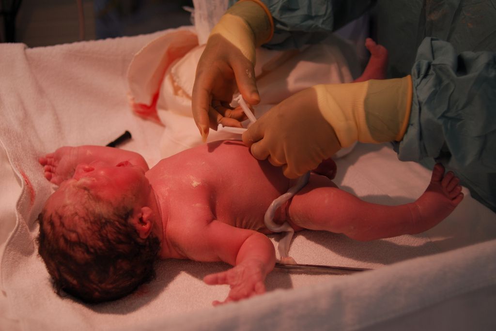 Badanie noworodka po porodzie