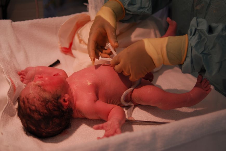 Badanie noworodka zaraz po porodzie 