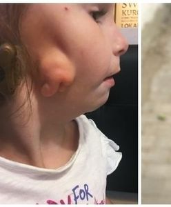 Szczecin. Skradziono pieniądze zbierane na leczenie 5-letniej Mai